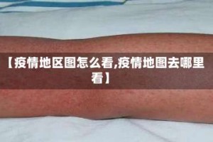 【疫情地区图怎么看,疫情地图去哪里看】